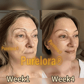 "Made and Shipped from America|✅ Official Store✨Purelora® Bee Venom Skin Restorative Cream 🔥 LAST DAY 80% OFF 💎"
