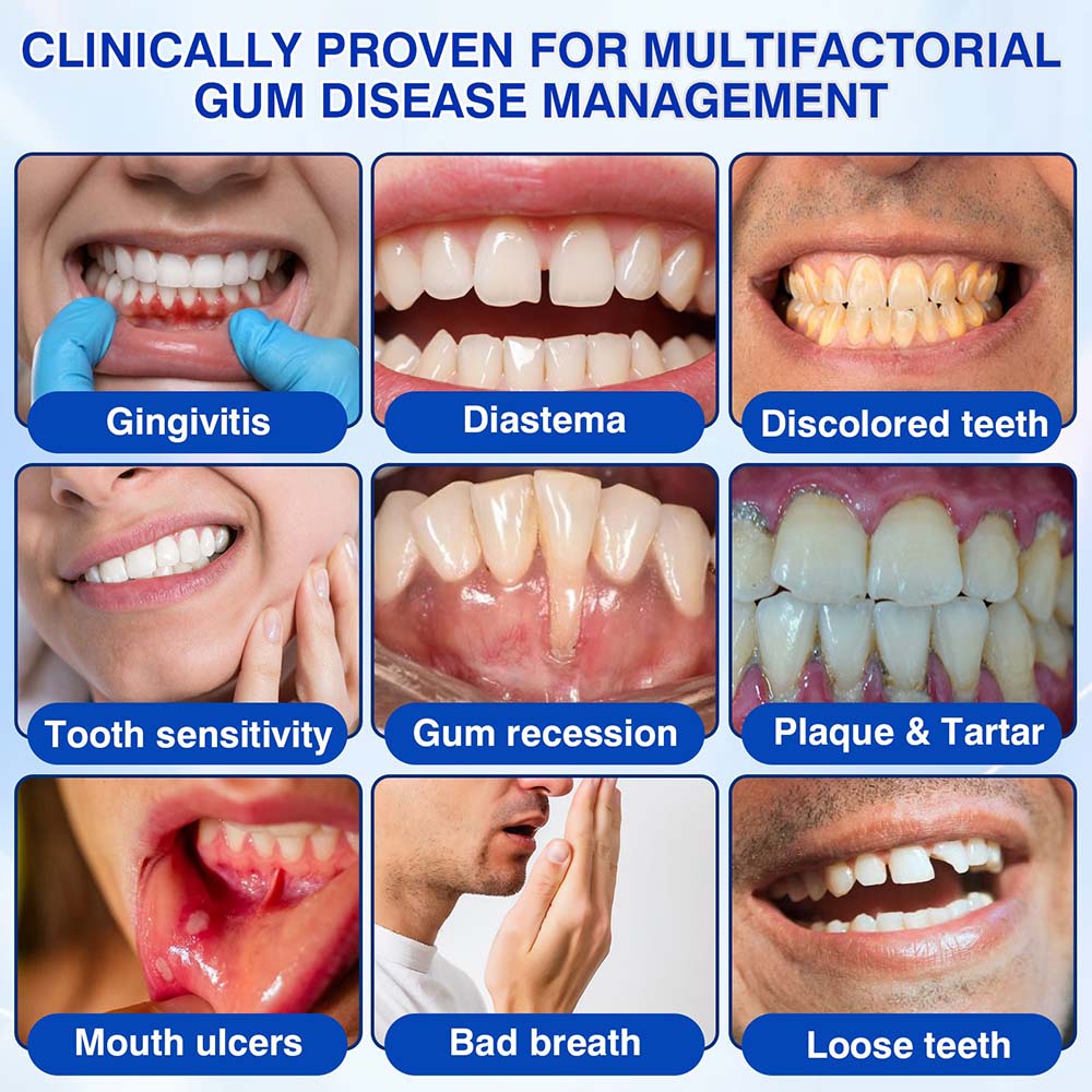 💎Purelora® GumRevive Periodontal Repair Gel