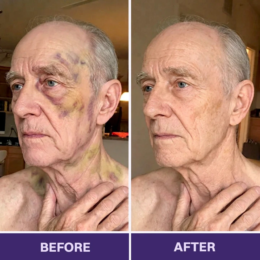 Purelora® Bruise Repair & Skin-Strengthening Cream