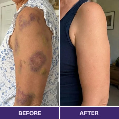 Purelora® Bruise Repair & Skin-Strengthening Cream